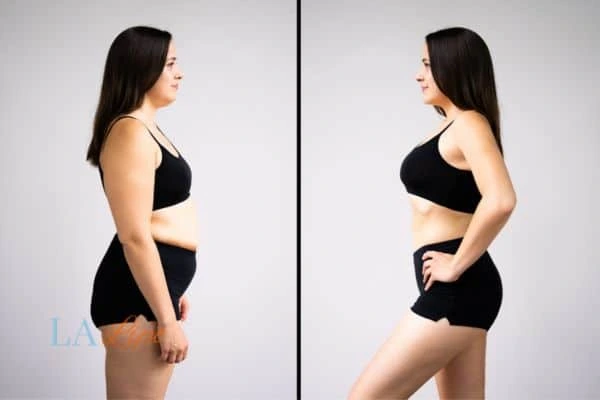 LA-EMS Body Sculpting Uppingham results before and after of womans results on body toning.