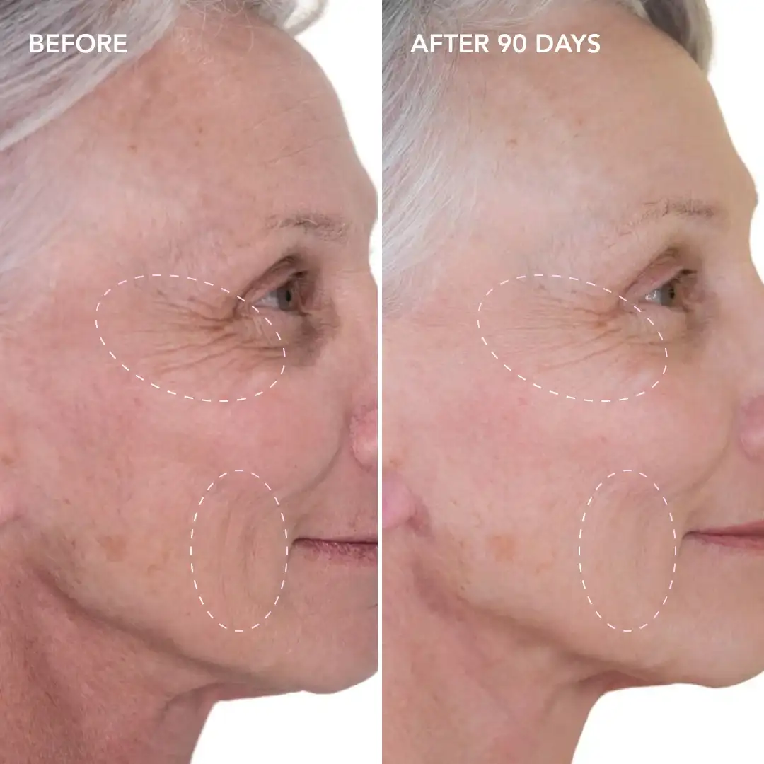 When will you see results Uppingham